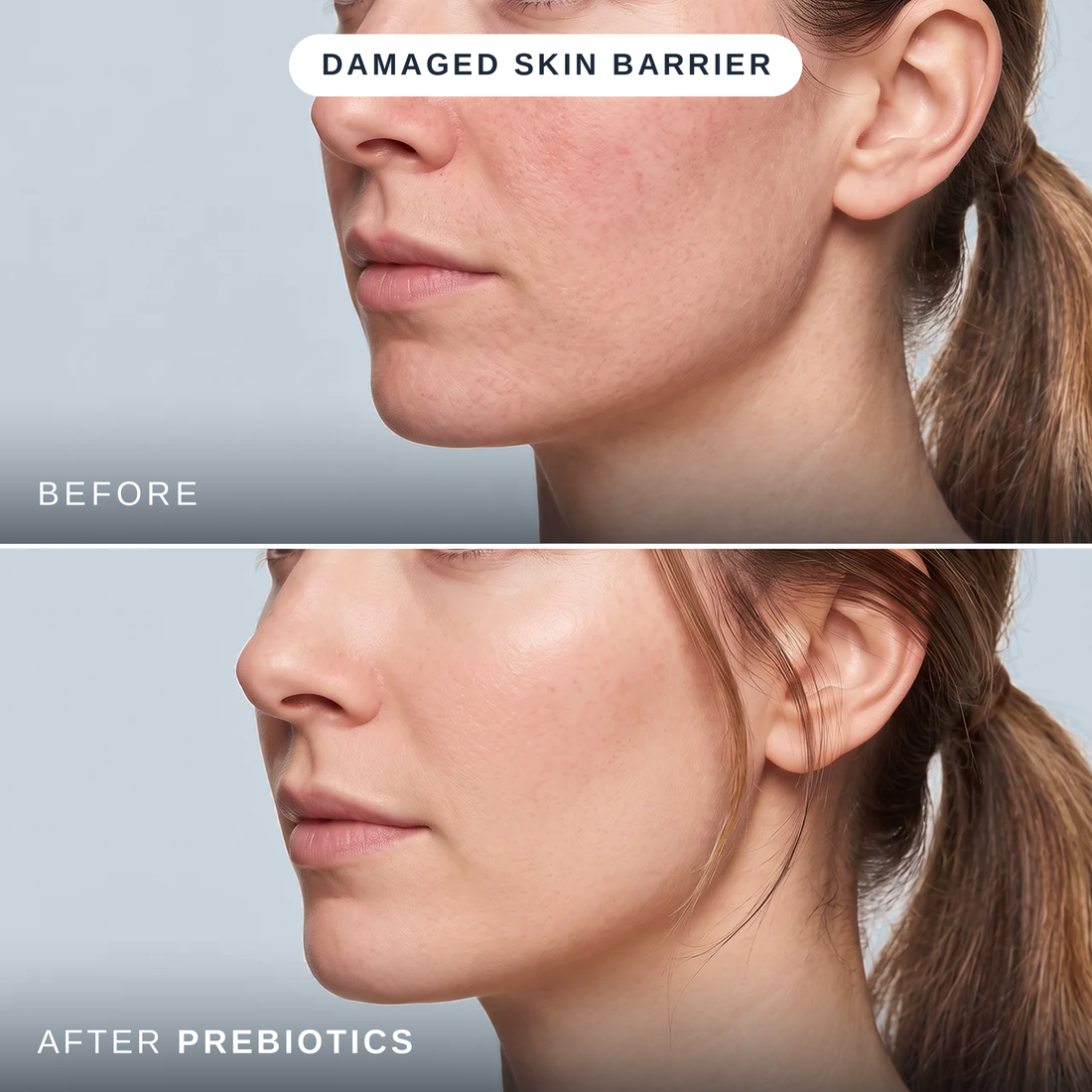 Prebiotic Recovery Serum